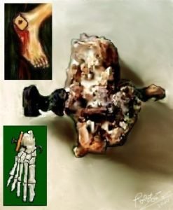 crucifixion givat hamivtar