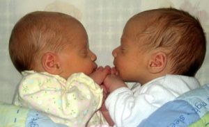 hizkiyya twins